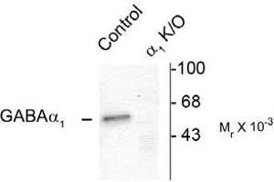 Image no. 2 for anti-gamma-aminobutyric Acid (GABA) A Receptor, alpha 1 (GABRA1) (N-Term) antibody (ABIN221189) (GABRA1 Antikörper  (N-Term))