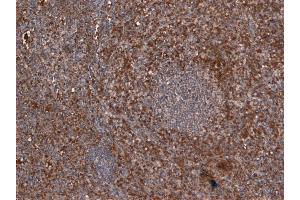 Immunohistochemistry (IHC) image for anti-Ionized Calcium-binding Adapter Molecule 1 (IBA1) (C-Term) antibody (ABIN184738)