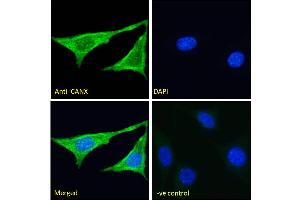 ABIN571025 Immunofluorescence analysis of paraformaldehyde fixed NIH3T3 cells, permeabilized with 0. (Calnexin Antikörper  (Internal Region))