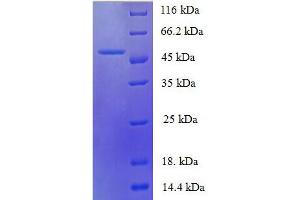 SDS-PAGE (SDS) image for Interleukin 6 (IL6) (AA 30-208), (full length) protein (His tag) (ABIN7479112)