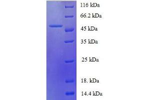 Protein expressed in E. (IL-6 Protein (AA 30-208, full length) (His tag))