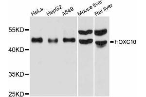 Western blot analysis of extracts of various cell lines, using HOXC10 antibody (ABIN6291152) at 1:1000 dilution. (HOXC10 Antikörper)