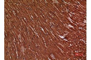 Immunohistochemistry (IHC) analysis of paraffin-embedded Mouse Heart, antibody was diluted at 1:100. (Troponin Complex T-C (Internal Region) Antikörper)