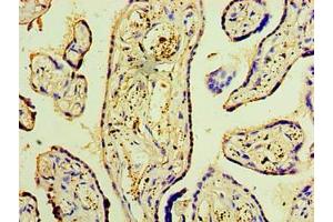 Immunohistochemistry of paraffin-embedded human placenta tissue using ABIN7150869 at dilution of 1:100 (DNAH3 Antikörper  (AA 1-150))