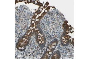 Immunohistochemical staining of human colon with TMEM130 polyclonal antibody  shows strong cytoplasmic positivity in glandular cells. (TMEM130 Antikörper)