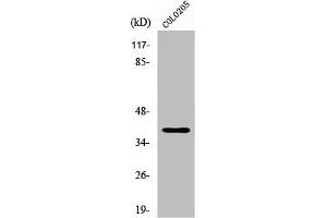 Western Blot analysis of COLO205 cells using XRCC4 Polyclonal Antibody (XRCC4 Antikörper  (C-Term))