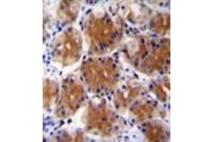 Formalin fixed and paraffin embedded human stomach tissue reacted FAM108C1 Antibody (Center) followed by peroxidase conjugation of the secondary antibody and DAB staining. (ABHD17C Antikörper  (Middle Region))