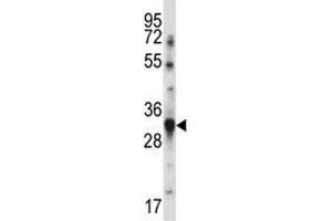 BAFF antibody western blot analysis in MDA-MB231 lysate. (BAFF Antikörper  (AA 16-44))