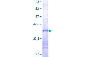 UTP14A Protein (AA 672-770) (GST tag)