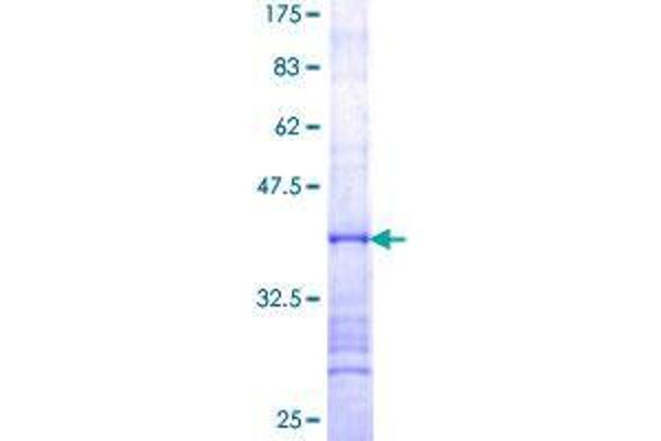 UTP14A Protein (AA 672-770) (GST tag)