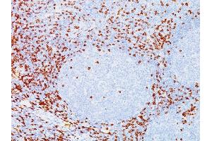 Formalin-fixed, paraffin-embedded human Tonsil stained with CD8A Mouse Monoclonal Antibody (C8/144B). (CD8 alpha Antikörper  (C-Term, Cytoplasmic Domain))