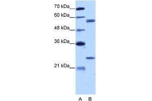 WB Suggested Anti-CPNE1 Antibody Titration:  5. (CPNE1 Antikörper  (N-Term))