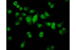 Immunofluorescence staining of Hela cells with ABIN7155703 at 1:100, counter-stained with DAPI. (HMX2 Antikörper  (AA 1-150))