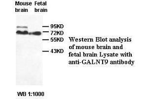 Image no. 2 for anti-Udp-N-Acetyl-alpha-D-Galactosamine:polypeptide N-Acetylgalactosaminyltransferase 9 (GalNAc-T9) (GALNT9) antibody (ABIN791210) (GALNT9 Antikörper)