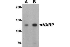 Western blot analysis of VARP in K562 cell lysate with VARP Antibody  at (A) 1 and (B) 2 μg/mL. (ANKRD27 Antikörper  (N-Term))