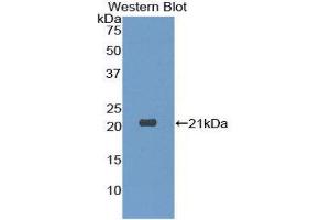Western Blotting (WB) image for anti-Dermatopontin (DPT) (AA 26-197) antibody (ABIN1175687) (Dermatopontin Antikörper  (AA 26-197))