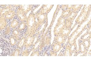 Detection of TNFRSF19 in Human Kidney Tissue using Polyclonal Antibody to Tumor Necrosis Factor Receptor Superfamily, Member 19 (TNFRSF19) (TNFRSF19 Antikörper  (AA 35-160))