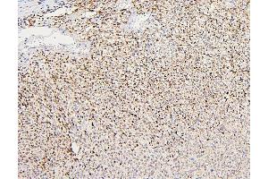 IHC analysis of PKD2 using anti-PKD2 antibody (ABIN7602539).