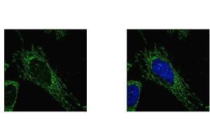 ICC/IF Image SUCLG1 antibody detects SUCLG1 protein at mitochondria by confocal immunofluorescent analysis. (SUCLG1 Antikörper)