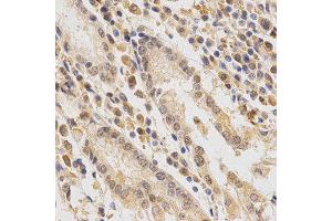Immunohistochemistry (IHC) image for anti-Feline Sarcoma Oncogene (FES) antibody (ABIN1872678) (FES Antikörper)