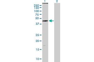 Western Blot analysis of ZDHHC11 expression in transfected 293T cell line by ZDHHC11 MaxPab polyclonal antibody. (ZDHHC11 Antikörper  (AA 1-412))