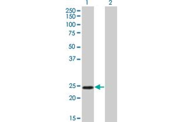 TWIST1 Antikörper  (AA 100-202)