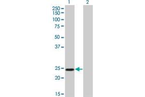 Western Blot analysis of TWIST1 expression in transfected 293T cell line by TWIST1 monoclonal antibody (M01), clone 3E11. (TWIST1 Antikörper  (AA 100-202))