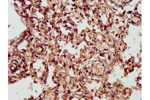 IHC image of ABIN7146680 diluted at 1:300 and staining in paraffin-embedded human lung tissue performed on a Leica BondTM system. (CHST11 Antikörper  (AA 214-330))