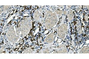 IHC analysis of CD20/MS4A1 using anti-CD20/MS4A1 antibody (ABIN7599233). (CD20 Antikörper  (AA 1-297))