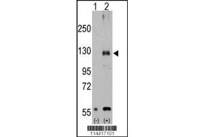 Western blot analysis of TRPM8 using rabbit polyclonal. (TRPM8 Antikörper  (AA 521-552))