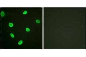 Immunofluorescence analysis of HeLa cells, using Histone H2B (Acetyl-Lys12) Antibody. (Histone H2B Antikörper  (acLys12))