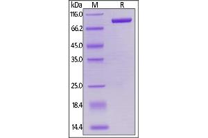 Biotinylated Human LAG-3, Mouse IgG2a Fc,Avitag on  under reducing (R) condition.