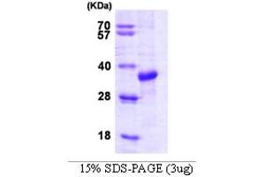 SDS-PAGE (SDS) image for STIP1 Homology and U-Box Containing Protein 1 (STUB1) (AA 1-303) protein (ABIN666729) (STUB1 Protein (AA 1-303))