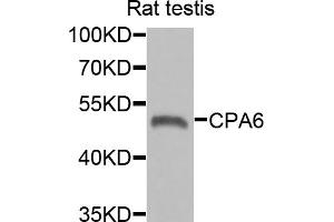 Western blot analysis of extracts of rat testis, using CPA6 antibody (ABIN5975028) at 1/1000 dilution.