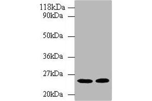 Western blot All lanes: HMGCR antibody at 2 μg/mL Lane 1: Hela whole cell lysate Lane 2: 293T whole cell lysate Secondary Goat polyclonal to rabbit IgG at 1/10000 dilution Predicted band size: 98, 93, 100 kDa Observed band size: 25 kDa (HMGCR Antikörper  (AA 588-887))