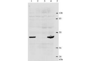 Western Blotting (WB) image for anti-Human Papilloma Virus Type 18 (HPV-18) (AA 1-83), (N-Term) antibody (ABIN781773) (HPV18 Antikörper  (N-Term))