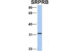 Host:  Rabbit  Target Name:  SRPRB  Sample Type:  Hela  Antibody Dilution:  1. (SRPRB Antikörper  (Middle Region))