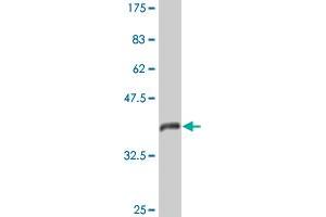 Western Blot detection against Immunogen (44. (ARF6 Antikörper  (AA 1-175))