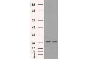 Image no. 4 for anti-Replication Protein A2, 32kDa (RPA2) antibody (ABIN1500736)