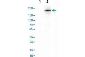 Western Blot analysis of Lane 1: negative control (vector only transfected HEK293T cell lysate) and Lane 2: over-expression lysate (co-expressed with a C-terminal myc-DDK tag in mammalian HEK293T cells) with PLA2R1 monoclonal antibody, clone CL0485 .
