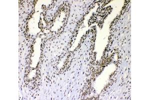 IHC analysis of nmt55/p54nrb using anti-nmt55/p54nrb antibody (ABIN3044530). (NONO Antikörper  (N-Term))