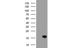 Image no. 2 for anti-Cellular Retinoic Acid Binding Protein 2 (CRABP2) antibody (ABIN1497620) (CRABP2 Antikörper)