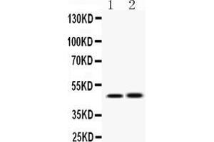 Western Blotting (WB) image for anti-Inhibitor of kappa Light Polypeptide Gene Enhancer in B-Cells, Kinase gamma (IKBKG) (AA 207-246), (Middle Region) antibody (ABIN4886630)