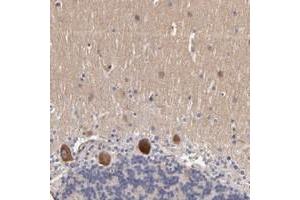 Immunohistochemical staining of human cerebellum with DACT1 polyclonal antibody  shows strong cytoplasmic positivity in purkinje cells. (DACT1 Antikörper)