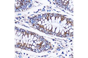 Immunohistochemistry of paraffin-embedded Human colon using IC Rabbit pAb (7500) at dilution of 1:100 (40x lens). (ICA1 Antikörper  (AA 1-160))
