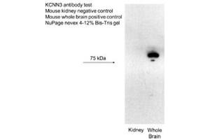 KCNN3 antibody - C-terminal region  validated by WB using Mouse kidney, Whole brain lysate at 2 ug/ml.
