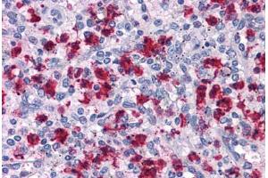 Human Spleen: Formalin-Fixed, Paraffin-Embedded (FFPE) (ARHGAP18 Antikörper  (C-Term))