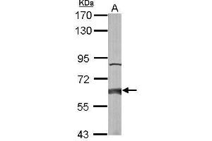 Western Blotting (WB) image for anti-2-Hydroxyacyl-CoA Lyase 1 (HACL1) (C-Term) antibody (ABIN2856448)