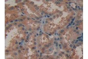 Figure. (MMP12 Antikörper  (AA 290-469))