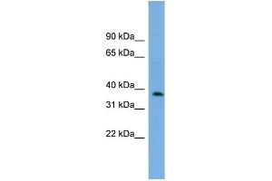 WB Suggested Anti-C17orf48 Antibody Titration: 0. (ADPRM Antikörper  (Middle Region))